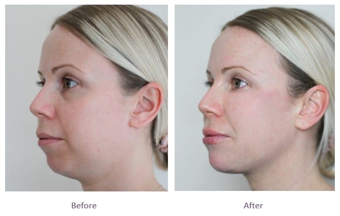 The Best Aesthetic Clinics in Dubai for Jawline Sculpting and Enhancement
